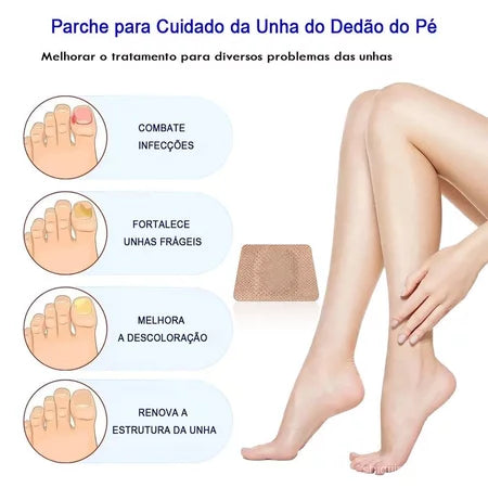 Adesivo para Tratamento de Fungos nas Unhas - Patch de Reparação Noturna (32 Unidades)