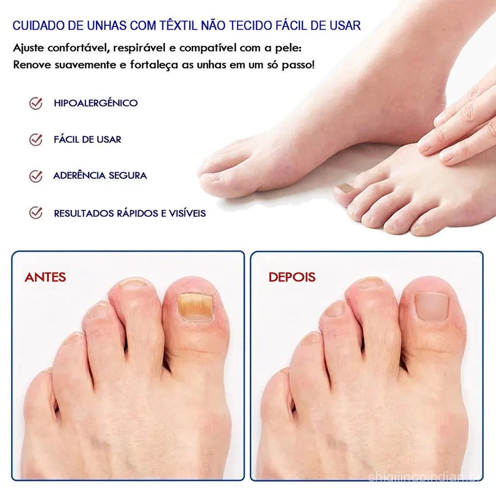 Adesivo para Tratamento de Fungos nas Unhas - Patch de Reparação Noturna (32 Unidades)