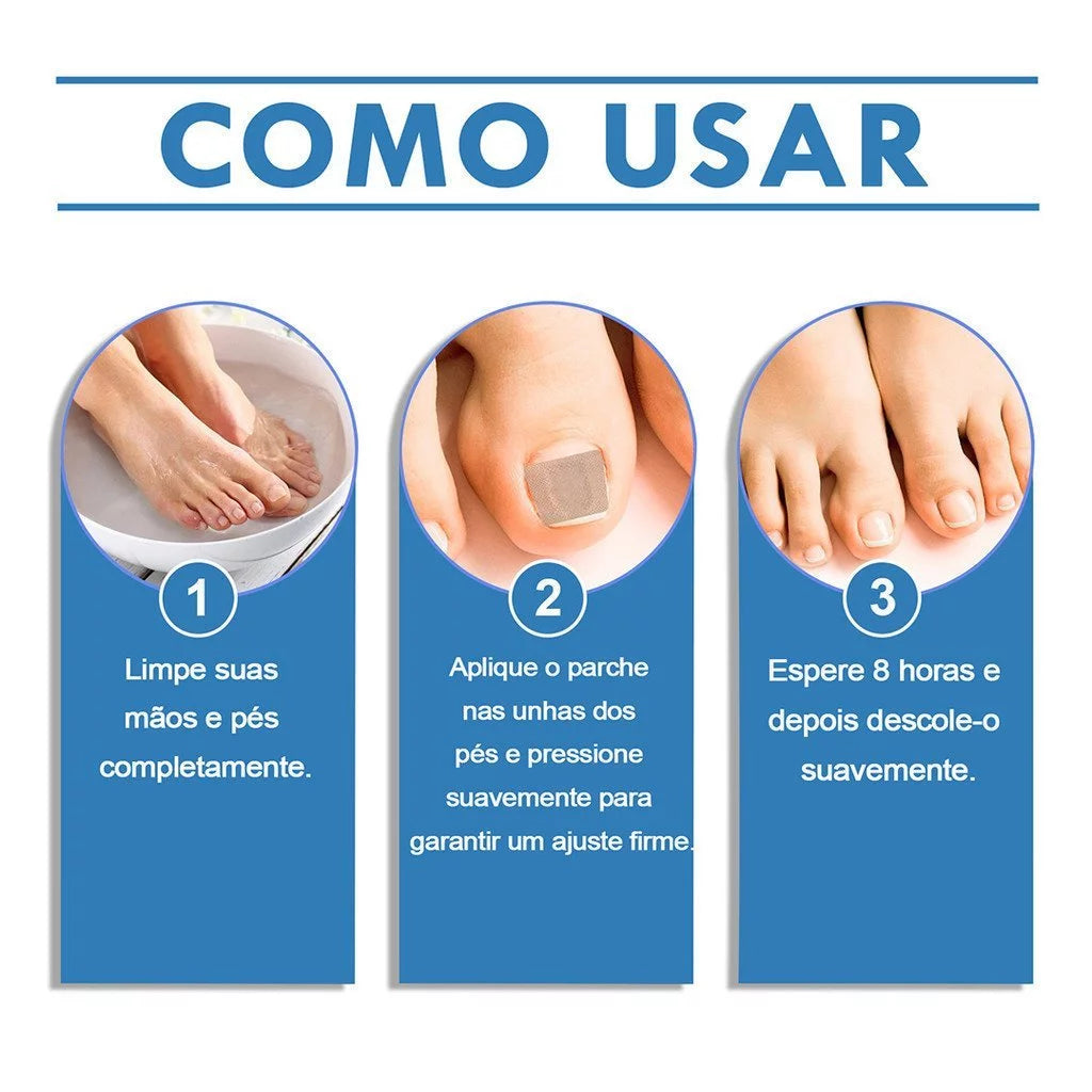 Adesivo para Tratamento de Fungos nas Unhas - Patch de Reparação Noturna (32 Unidades)