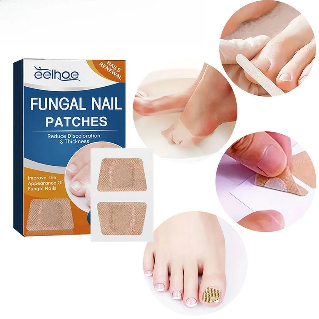 Adesivo para Tratamento de Fungos nas Unhas - Patch de Reparação Noturna (32 Unidades)