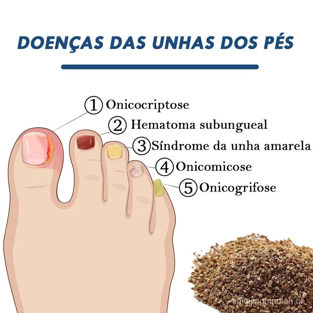 Adesivo para Tratamento de Fungos nas Unhas - Patch de Reparação Noturna (32 Unidades)