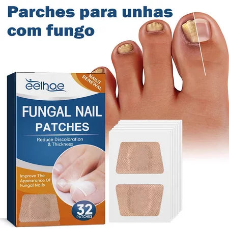 Adesivo para Tratamento de Fungos nas Unhas - Patch de Reparação Noturna (32 Unidades)